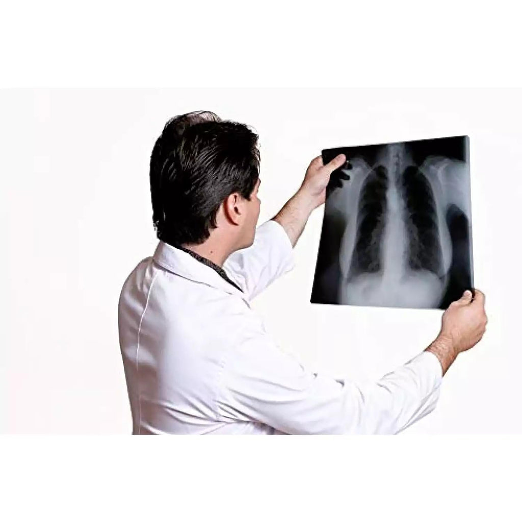 Blue Inkjet Xray Film | Size 10"×12" | Qty. 100 Films
