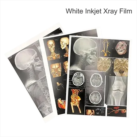 White Inkjet X-Ray Film | Size 8X10 | 100 Film For CT, MRI Secondary image