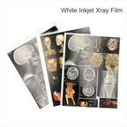 White Inkjet X-Ray Film | Size 8X10 | 100 Film For CT, MRI