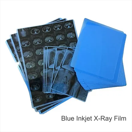 Blue Inkjet Xray Film | Size A3 | Qty. 100 Films