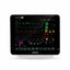 Biolight Compact Patient Monitor S-12 | 12.1 inch Display