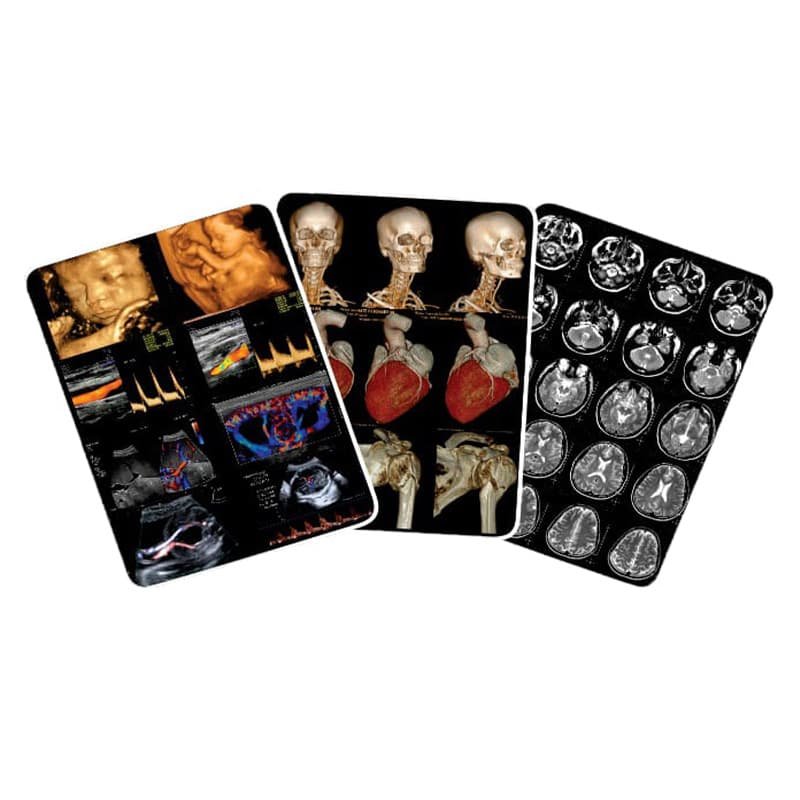 White Inkjet X-Ray Film | Size A3 | 100 Film For CT, MRI Secondary image