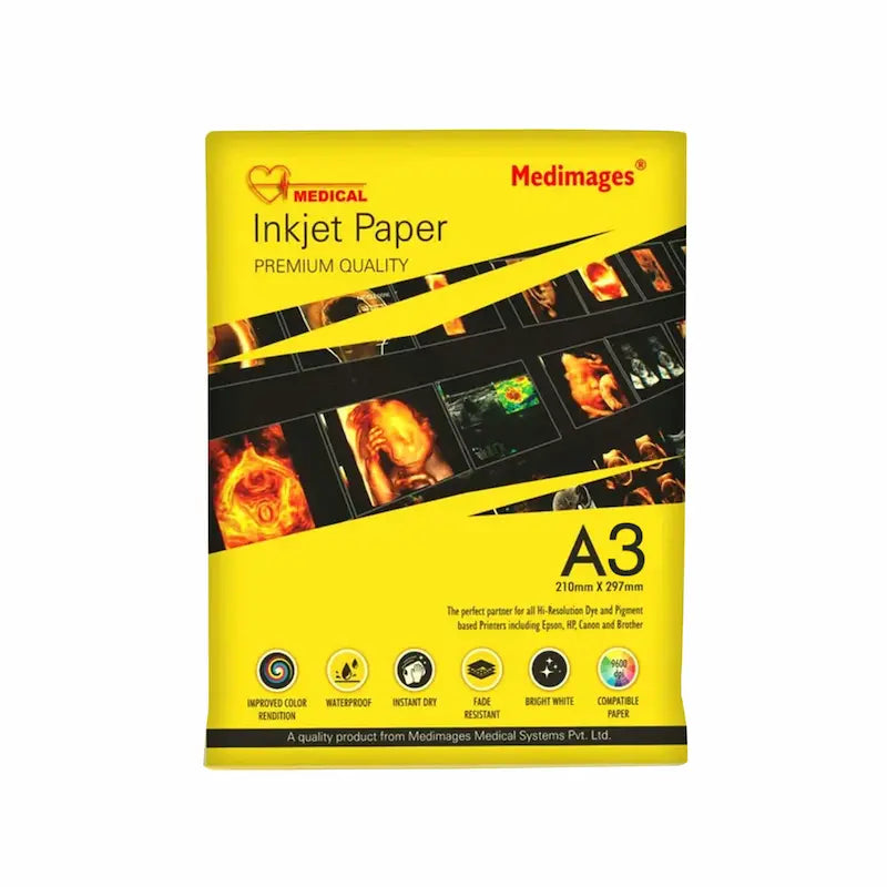 Ultrasound Paper | Size A3 | 180 GSM | Glossy | 50 Sheets
